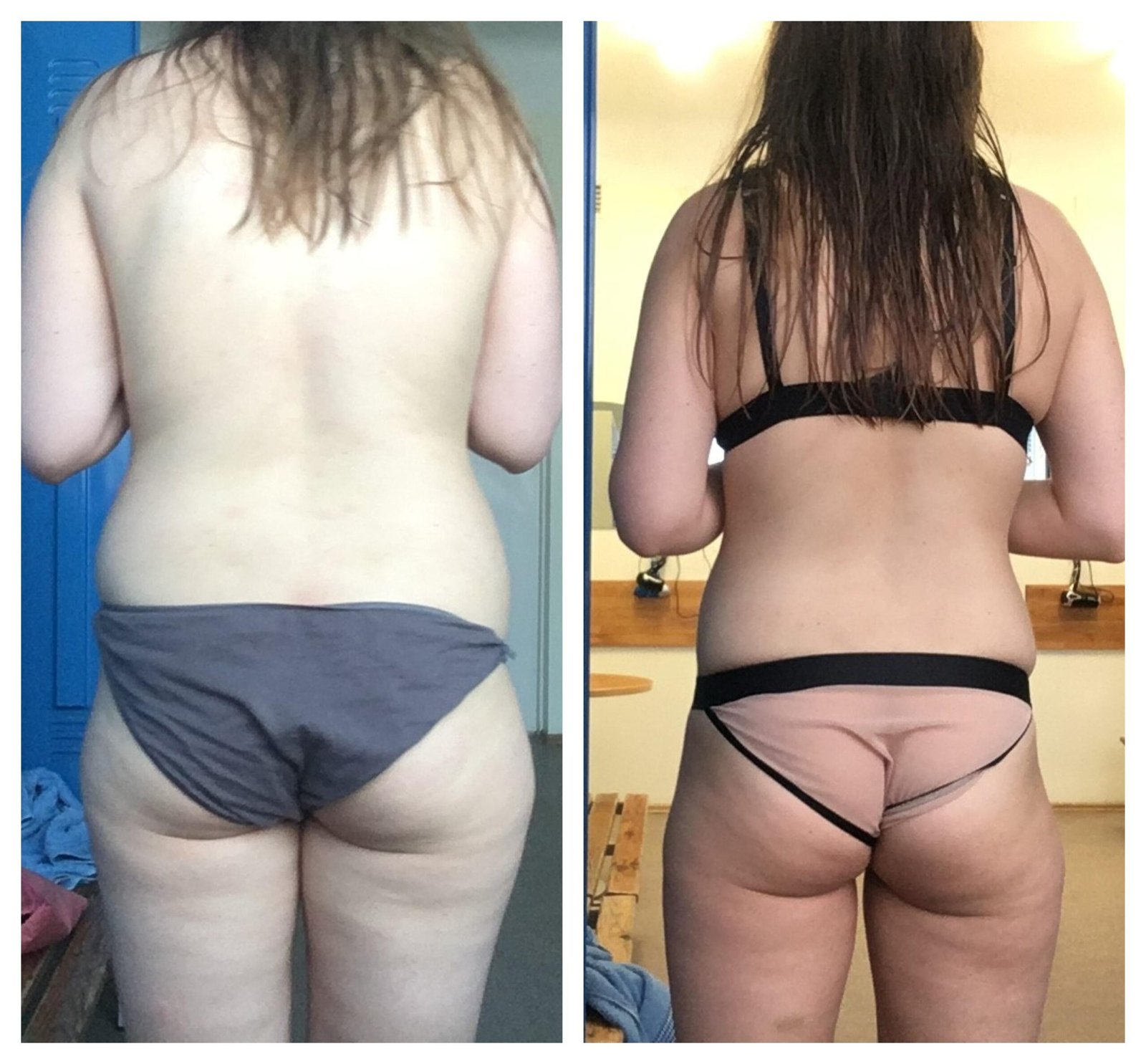 Cellulite Before and After Weight Lifting: Real ations